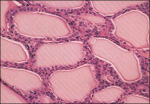 Клетки щитовидной железы